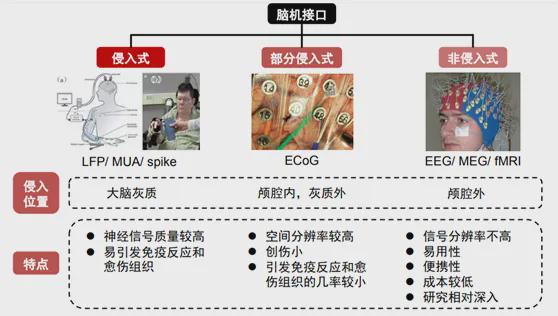 九游智能体育科技：意念键盘来了：脑机接口下一个风口？(图5)