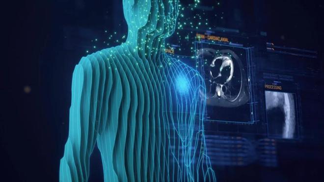 聚龄高科技电子WMS用户飞利浦AI与精准医疗重塑卒中护理未来(图1)